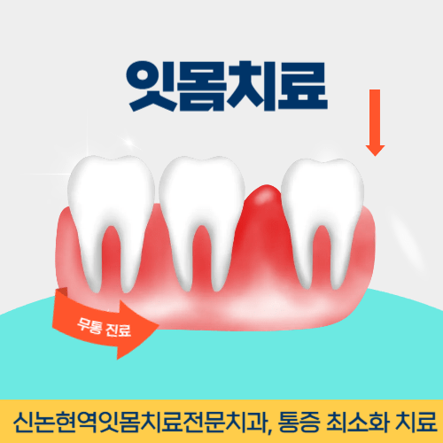 대구치과 대구광역시 치과 잇몸치료